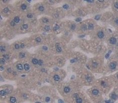 Polyclonal Antibody to Fibrinogen Alpha Chain (FGA)