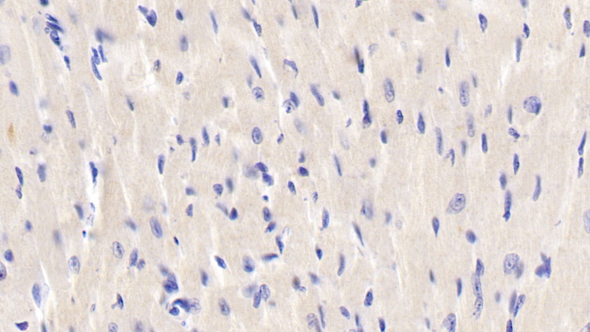 Polyclonal Antibody to c-Jun N-terminal Kinase 1 (JNK1)