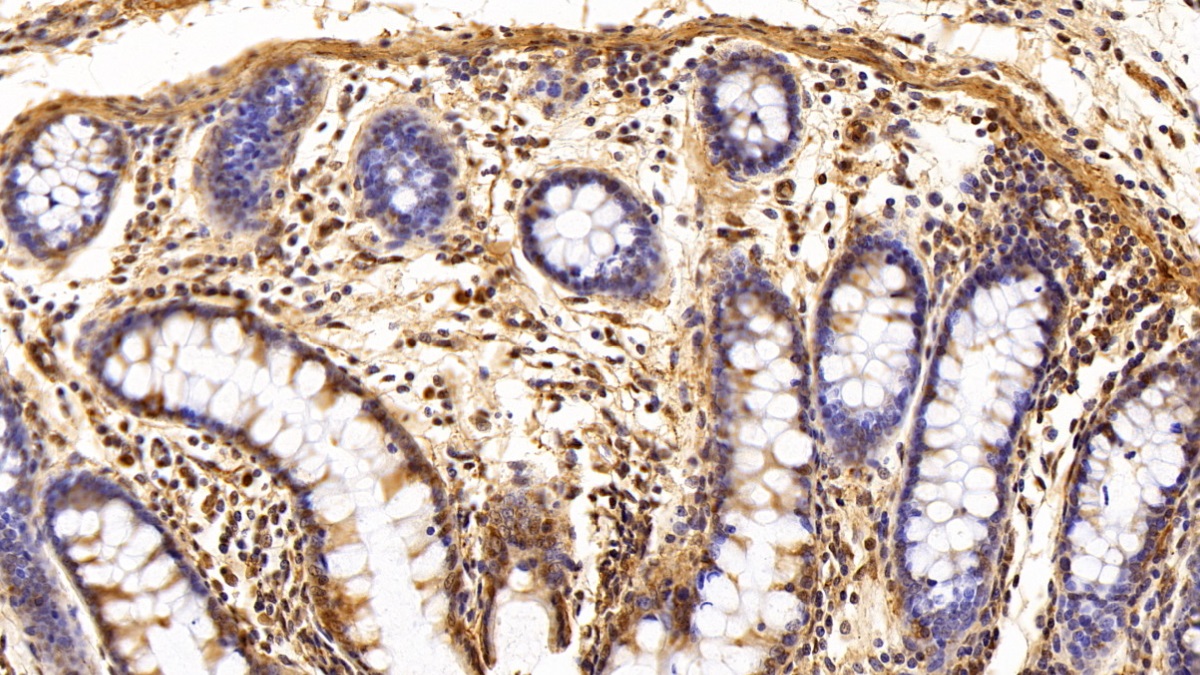 Polyclonal Antibody to Thioredoxin-interacting Protein (TXNIP)