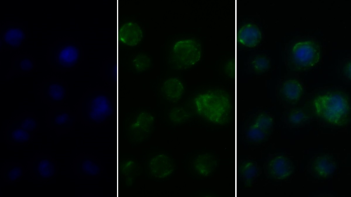 Polyclonal Antibody to Cluster Of Differentiation 4 (CD4)