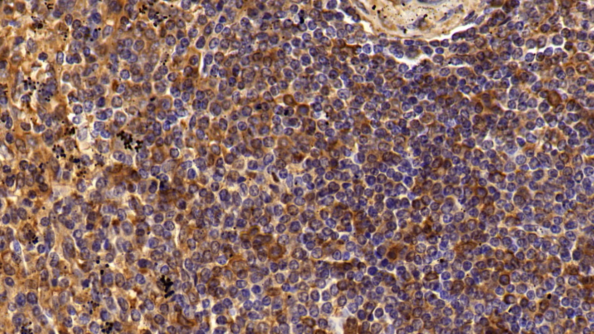 Polyclonal Antibody to Cluster Of Differentiation 4 (CD4)