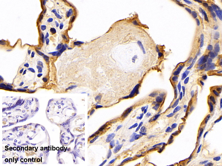 Polyclonal Antibody to Transferrin Receptor (TFR)