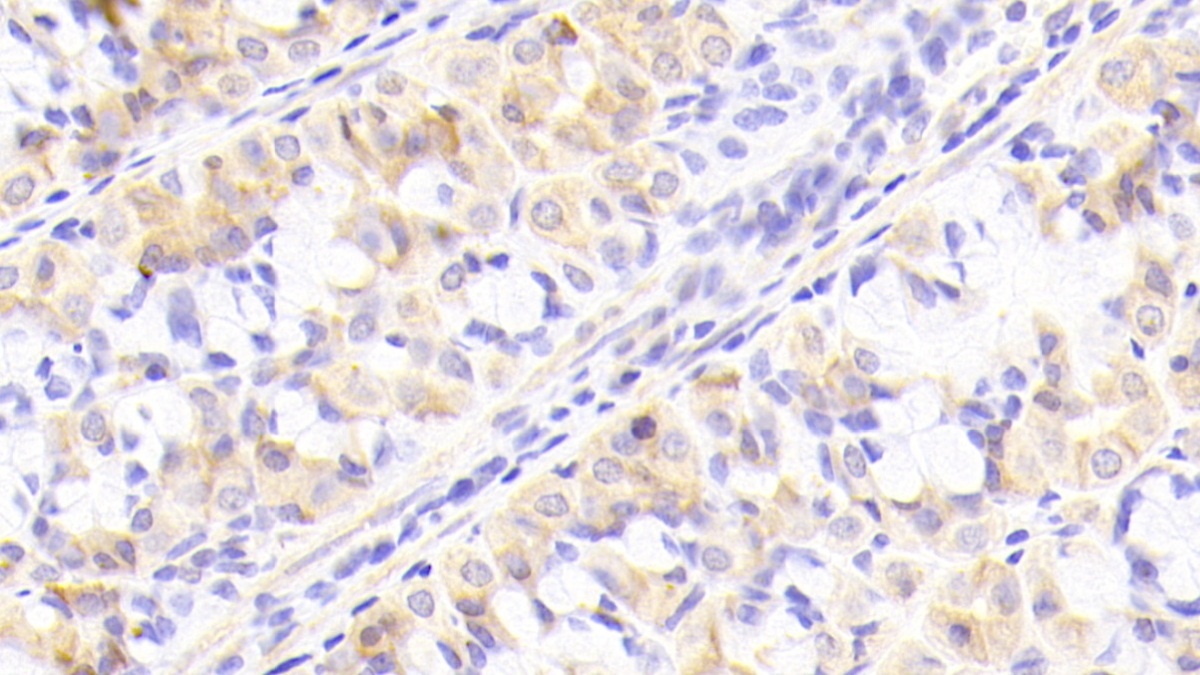 Polyclonal Antibody to Nucleoporin 205kDa (NUP205)