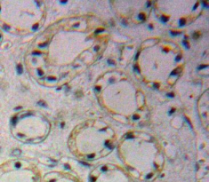 Polyclonal Antibody to Glucose Transporter 1 (GLUT1)