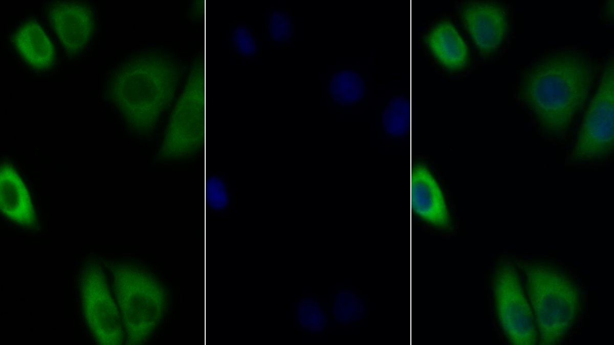 Polyclonal Antibody to Interleukin 27 Receptor Alpha (IL27Ra)