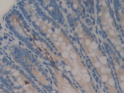 Polyclonal Antibody to Cartilage Oligomeric Matrix Protein (COMP)