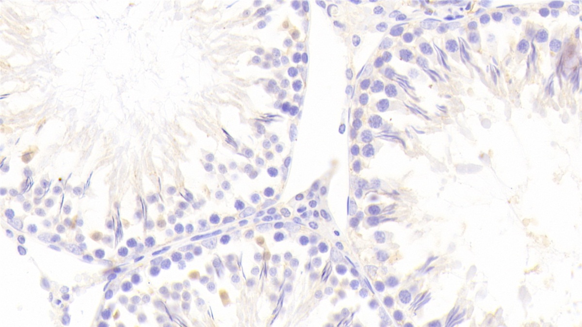 Polyclonal Antibody to Cartilage Oligomeric Matrix Protein (COMP)