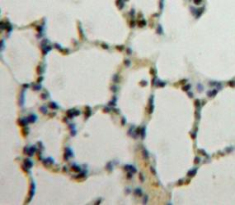 Polyclonal Antibody to Nucleoporin 88 (NUP88)