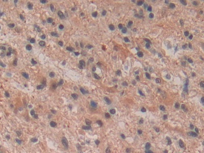 Polyclonal Antibody to Neurokinin B (NKB)