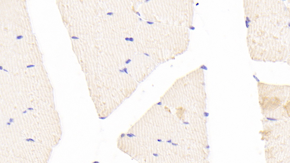 Polyclonal Antibody to Contactin 2 (CNTN2)