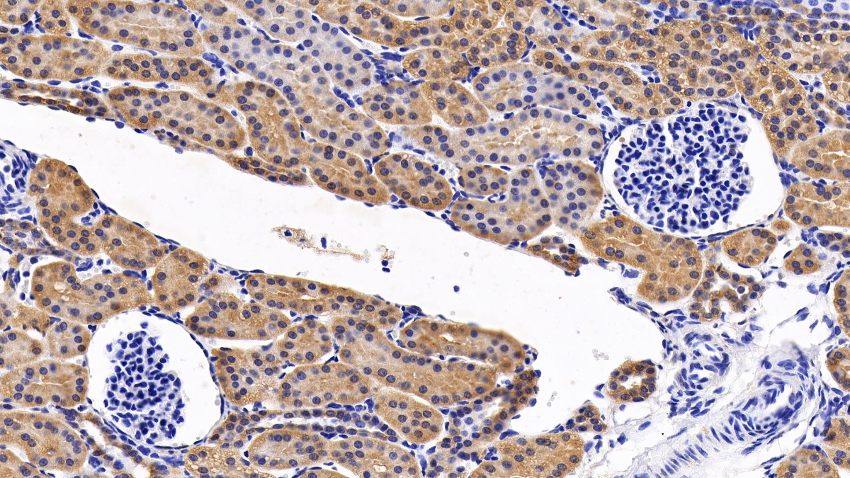 Polyclonal Antibody to Mitogen Activated Protein Kinase 14 (MAPK14)