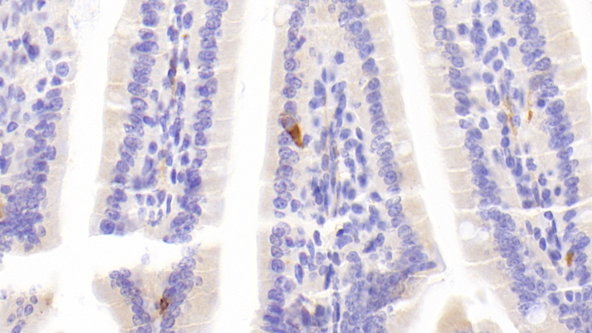 Polyclonal Antibody to Chromogranin A (CHGA)