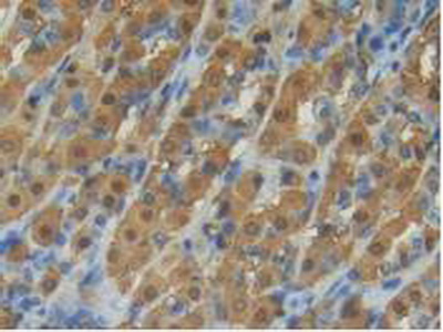 Polyclonal Antibody to Aspartate Aminotransferase (AST)