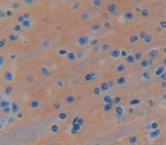 Polyclonal Antibody to Synuclein Alpha (SNCa)