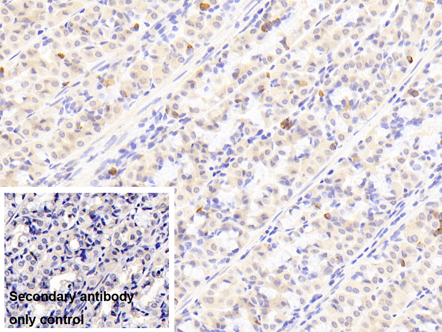 Polyclonal Antibody to Gastrin (GT)