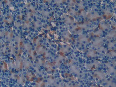 Polyclonal Antibody to Corticosteroid Binding Globulin (CBG)