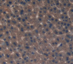 Polyclonal Antibody to Corticosteroid Binding Globulin (CBG)