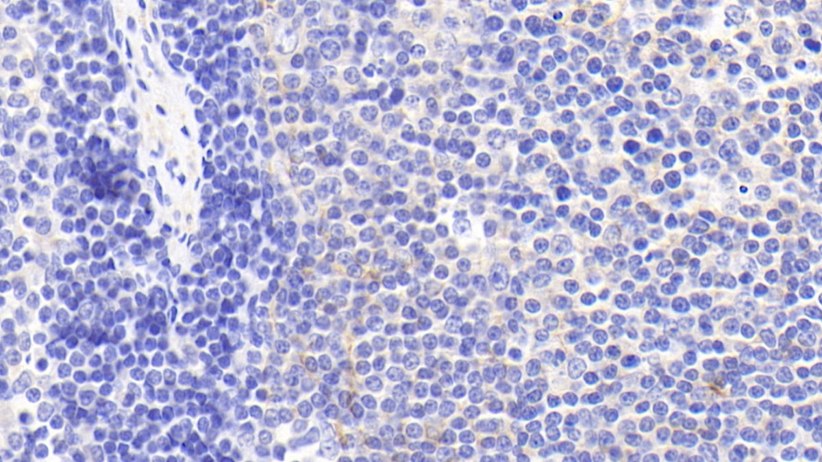 Polyclonal Antibody to Cholinergic Receptor, Muscarinic 4 (CHRM4)