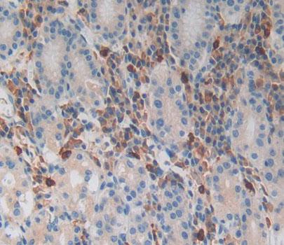 Polyclonal Antibody to MAX Gene Associated Protein (MgA)