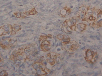 Polyclonal Antibody to Cytokeratin 18 (CK18)