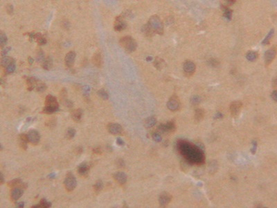 Polyclonal Antibody to Cytokeratin 18 (CK18)