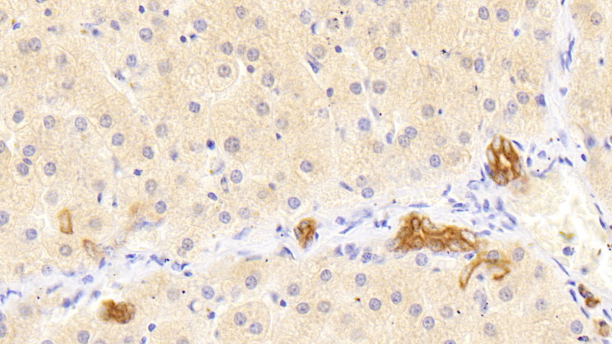 Polyclonal Antibody to Cytokeratin 18 (CK18)