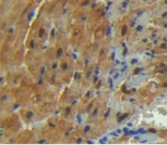 Polyclonal Antibody to Cyclin Dependent Kinase 4 (CDK4)