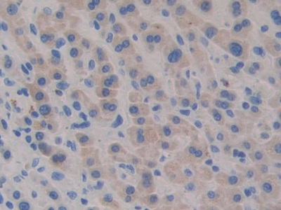 Polyclonal Antibody to Bactericidal/Permeability Increasing Protein (BPI)