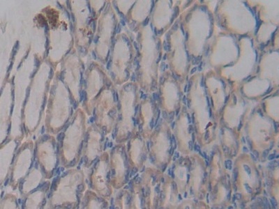 Polyclonal Antibody to Bactericidal/Permeability Increasing Protein (BPI)