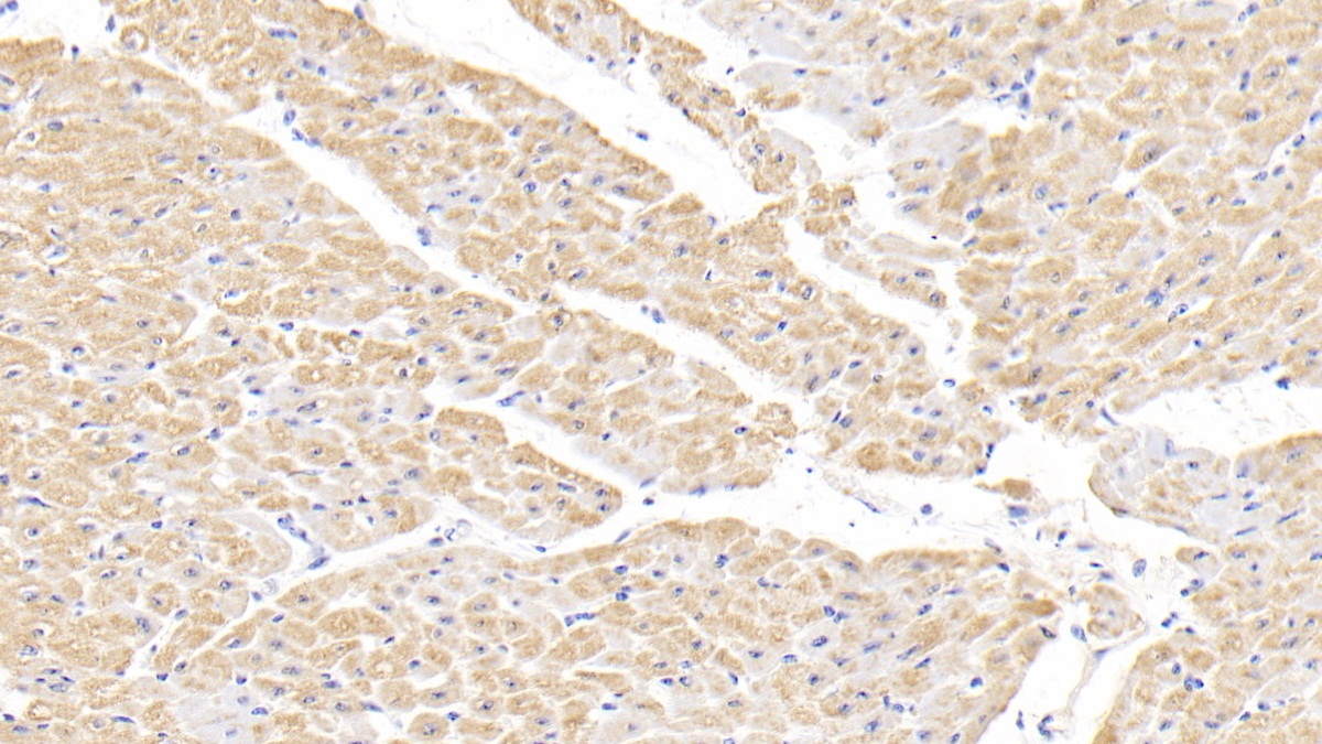 Polyclonal Antibody to Heart-type Fatty Acid Binding Protein (H-FABP)