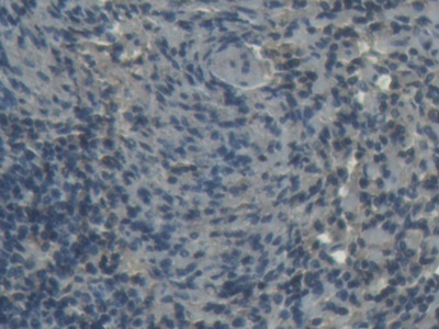 Polyclonal Antibody to Heart-type Fatty Acid Binding Protein (H-FABP)