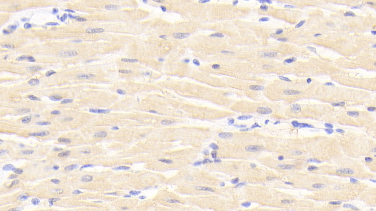 Polyclonal Antibody to Heart-type Fatty Acid Binding Protein (H-FABP)