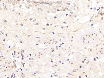 Polyclonal Antibody to Androgen Receptor (AR)