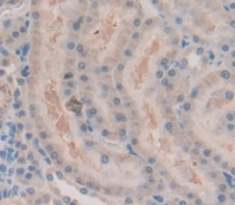 Polyclonal Antibody to Androgen Receptor (AR)