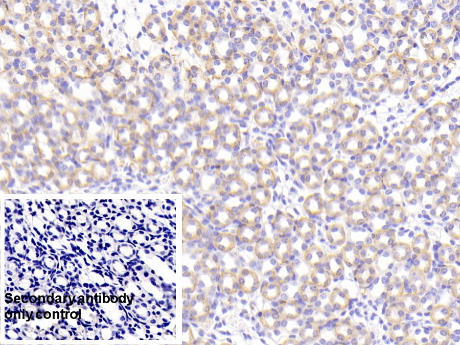 Polyclonal Antibody to Prolylcarboxypeptidase (PRCP)