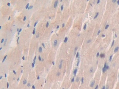 Polyclonal Antibody to Prolylcarboxypeptidase (PRCP)