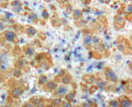 Polyclonal Antibody to Angiostatin (ANG)