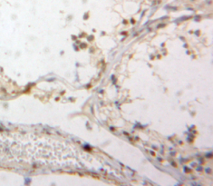 Polyclonal Antibody to Down Regulator Of Transcription 1, TBP Binding (DR1)