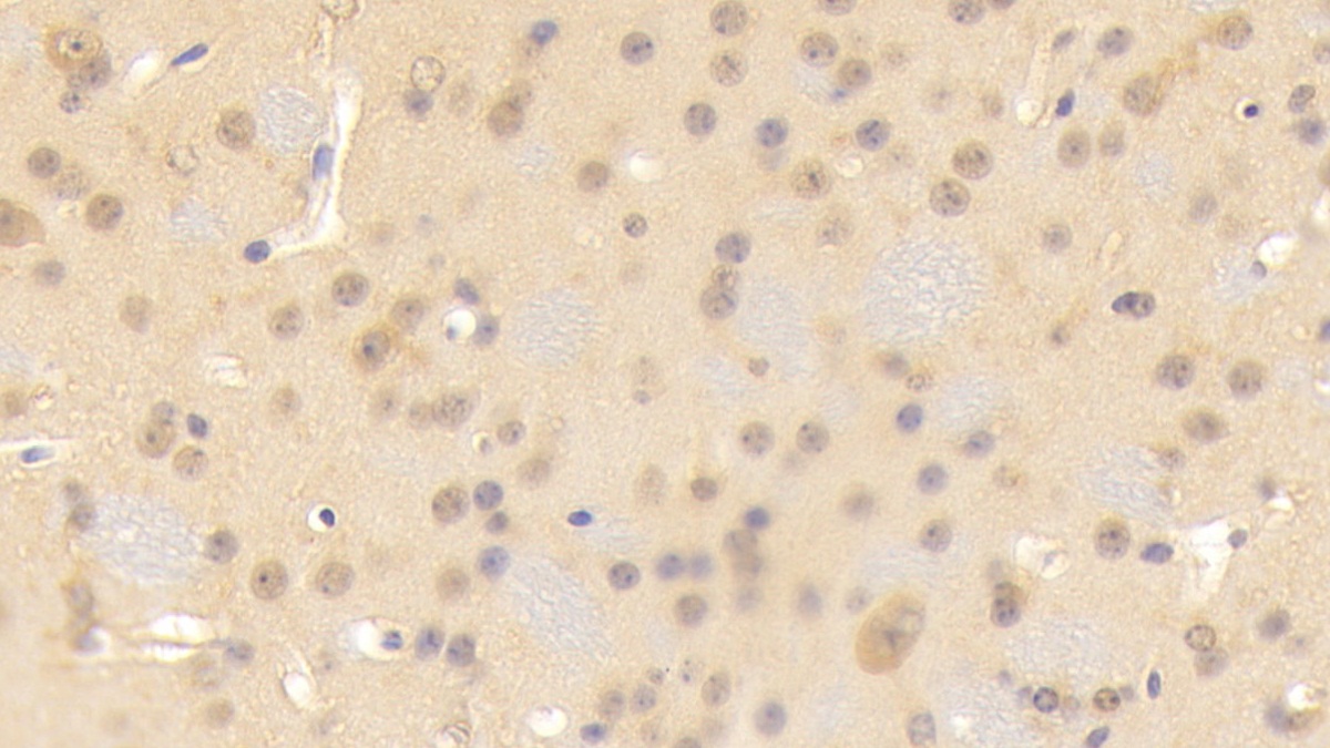 Polyclonal Antibody to Contactin 3 (CNTN3)