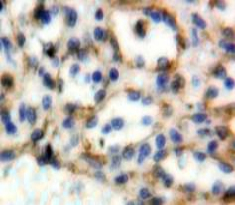 Polyclonal Antibody to Cluster Of Differentiation 72 (CD72)