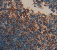 Polyclonal Antibody to Cluster Of Differentiation 72 (CD72)