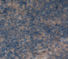 Polyclonal Antibody to Cluster Of Differentiation 72 (CD72)