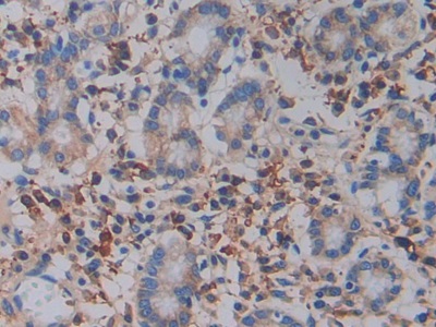 Polyclonal Antibody to Integrin Beta 3 (ITGb3)