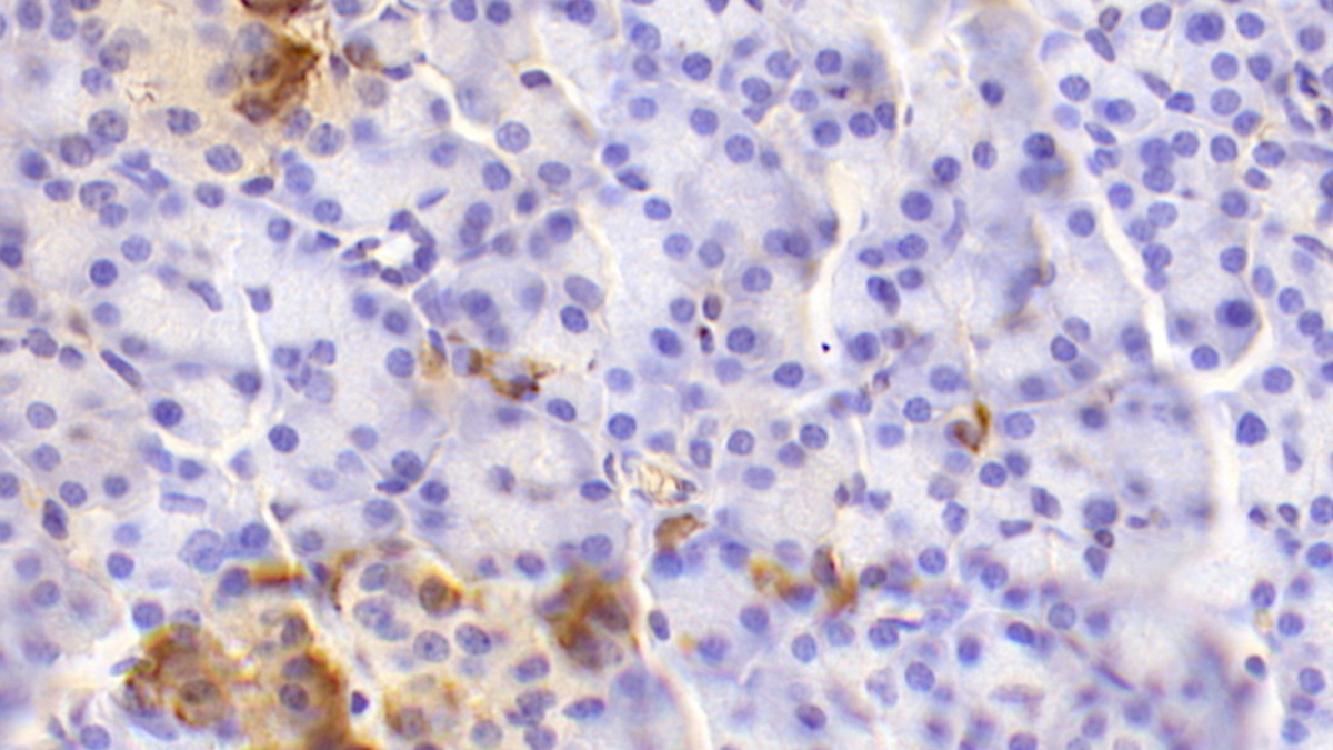 Polyclonal Antibody to Glucagon (GCG)