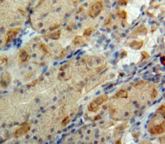 Polyclonal Antibody to Glucagon (GCG)