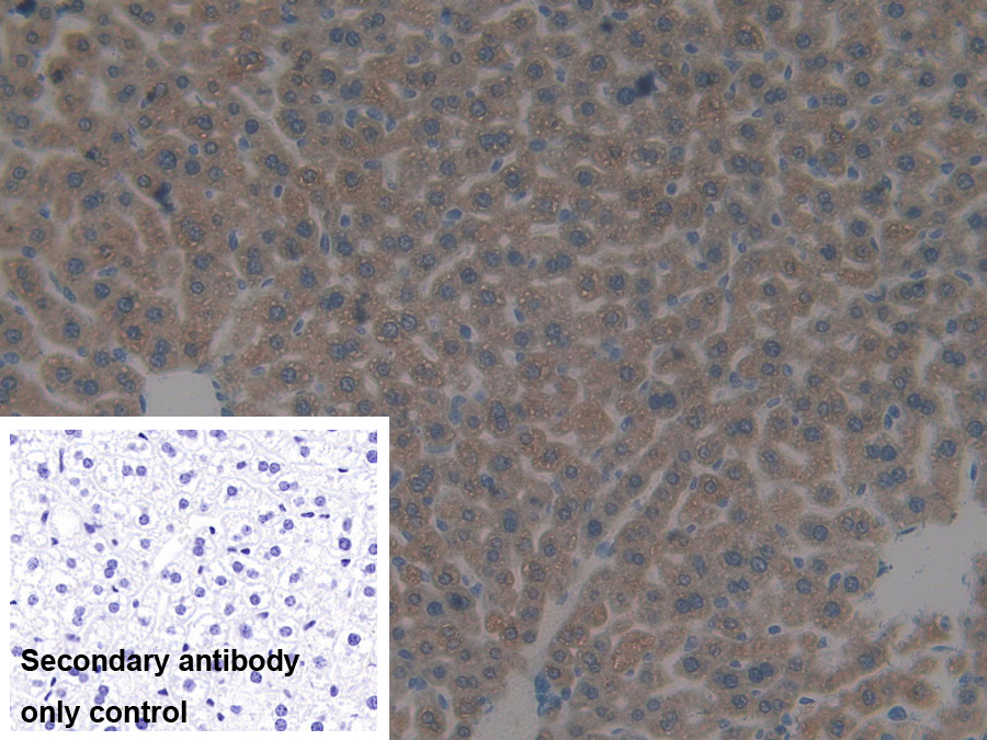 Polyclonal Antibody to Sulfotransferase 1A1 (SULT1A1)