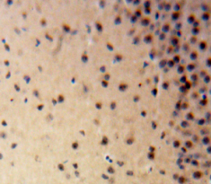 Polyclonal Antibody to ATP Dependent DNA ligase I (LIG1)