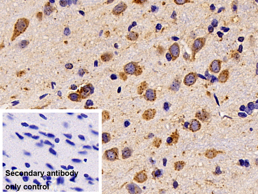 Polyclonal Antibody to Cathepsin D (CTSD)