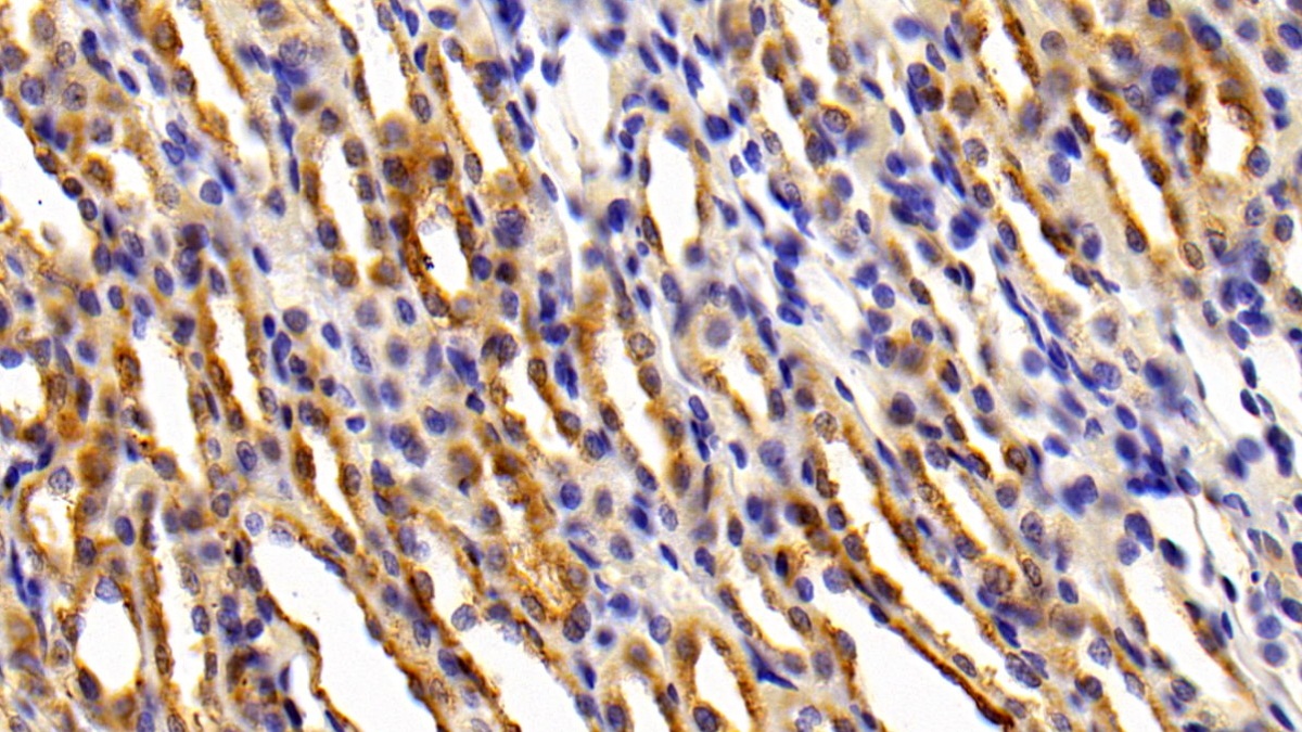 Polyclonal Antibody to Cathepsin D (CTSD)