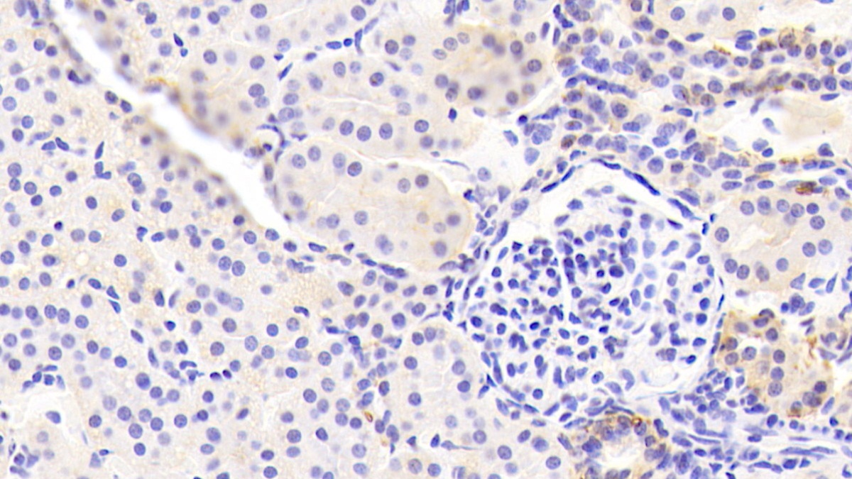 Polyclonal Antibody to Epithelial Cell Adhesion Molecule (EPCAM)